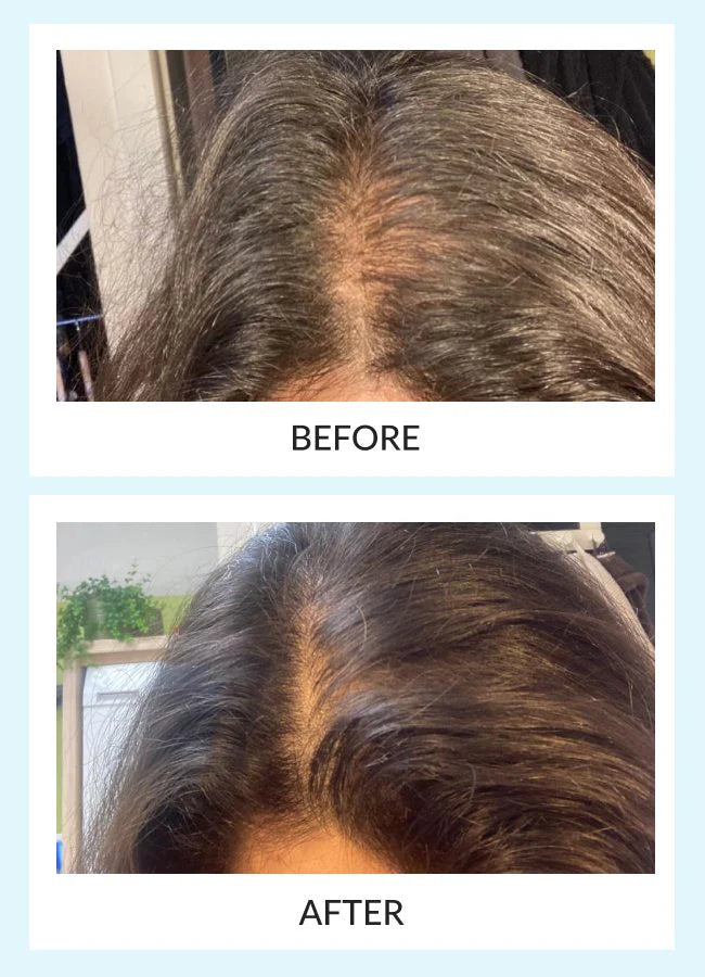 Hair Force Serum and Booster LED Kit